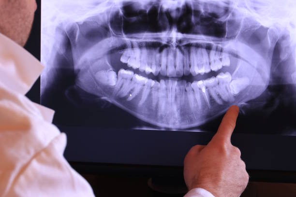 Best Emergency Dental Care for Sports Injuries in Rushville, NE